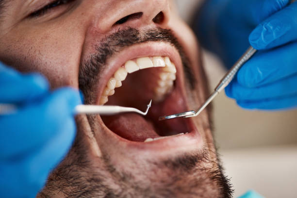 Best Tooth Infection Emergency Dentist  in Greenwood, MO