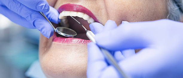 Best Knocked-Out Tooth Emergency  in Greenwood, MO